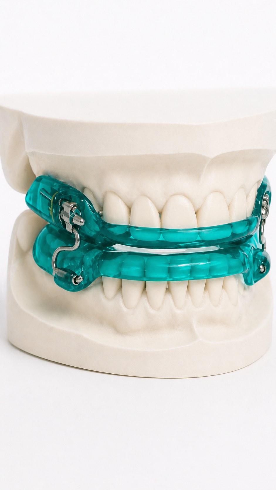 Aparelho intraoral transparente sob medida